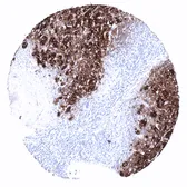 Anti-Thyroglobulin antibody [MSVA-189R] HistoMAX used in IHC (Paraffin sections) (IHC-P). GTX04365