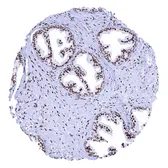 Anti-Androgen Receptor antibody [MSVA-367R] HistoMAX&trade; used in IHC (Paraffin sections) (IHC-P). GTX04368