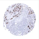 Anti-Mesothelin antibody [MSVA-235M] HistoMAX&trade; used in IHC (Paraffin sections) (IHC-P). GTX04373