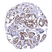 Anti-Mesothelin antibody [MSVA-235M] HistoMAX used in IHC (Paraffin sections) (IHC-P). GTX04373
