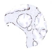 Anti-Cytokeratin 14 antibody [MSVA-614R] HistoMAX&trade; used in IHC (Paraffin sections) (IHC-P). GTX04377