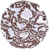 Anti-EpCAM antibody [MSVA-326R] HistoMAX used in IHC (Paraffin sections) (IHC-P). GTX04380
