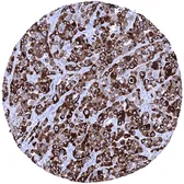 Anti-Melanoma gp100 antibody [MSVA-617R] HistoMAX&trade; used in IHC (Paraffin sections) (IHC-P). GTX04382