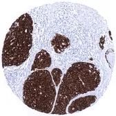 Anti-Melan A antibody [MSVA-900M] HistoMAX&trade; used in IHC (Paraffin sections) (IHC-P). GTX04383