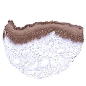 Anti-Cytokeratin 13 antibody [MSVA-613M] HistoMAX&trade; used in IHC (Paraffin sections) (IHC-P). GTX04385