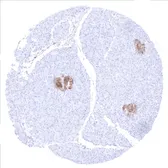 Anti-NSE antibody [MSVA-451M] HistoMAX&trade; used in IHC (Paraffin sections) (IHC-P). GTX04388