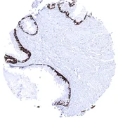 Anti-Cytokeratin 5 antibody [MSVA-605M] HistoMAX&trade; used in IHC (Paraffin sections) (IHC-P). GTX04402
