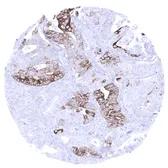Anti-Cytokeratin 6 antibody [MSVA-606R] HistoMAX&trade; used in IHC (Paraffin sections) (IHC-P). GTX04403