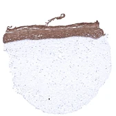 Anti-Cytokeratin 6 antibody [MSVA-606R] HistoMAX&trade; used in IHC (Paraffin sections) (IHC-P). GTX04403