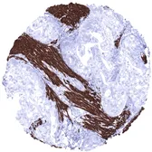 Anti-Desmin antibody [MSVA-651M] HistoMAX&trade; used in IHC (Paraffin sections) (IHC-P). GTX04410