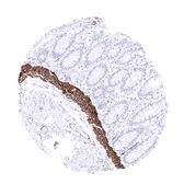 Anti-Desmin antibody [MSVA-651M] HistoMAX&trade; used in IHC (Paraffin sections) (IHC-P). GTX04410