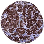 Anti-Inhibin alpha antibody [MSVA-561R] HistoMAX used in IHC (Paraffin sections) (IHC-P). GTX04415