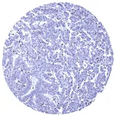 Anti-MSH6 antibody [MSVA-906R] HistoMAX&trade; used in IHC (Paraffin sections) (IHC-P). GTX04416