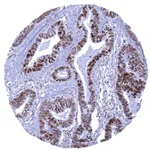 Anti-MSH6 antibody [MSVA-906R] HistoMAX&trade; used in IHC (Paraffin sections) (IHC-P). GTX04416