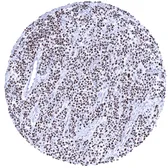 Anti-MyoD1 antibody [MSVA-801R] HistoMAX&trade; used in IHC (Paraffin sections) (IHC-P). GTX04419