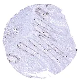 Anti-Topoisomerase II alpha antibody [MSVA-802R] HistoMAX&trade; used in IHC (Paraffin sections) (IHC-P). GTX04422