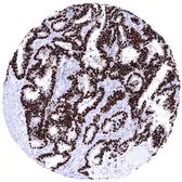 Anti-Progesterone Receptor antibody [MSVA-570R] HistoMAX&trade; used in IHC (Paraffin sections) (IHC-P). GTX04431