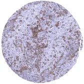 Anti-TIM-3 antibody [MSVA-366R] HistoMAX used in IHC (Paraffin sections) (IHC-P). GTX04440