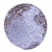Anti-ZAP70 antibody [MSVA-870R] HistoMAX&trade; used in IHC (Paraffin sections) (IHC-P). GTX04441