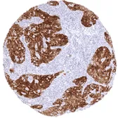 Anti-CDKN2A / p16INK4a antibody [MSVA-016R] HistoMAX&trade; used in IHC (Paraffin sections) (IHC-P). GTX04442