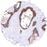 Anti-LI-Cadherin antibody [MSVA-517M] HistoMAX&trade; used in IHC (Paraffin sections) (IHC-P). GTX04447