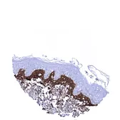 Anti-Periostin antibody [MSVA-649M] HistoMAX used in IHC (Paraffin sections) (IHC-P). GTX04460