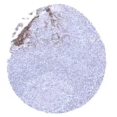 Anti-Desmoglein 3 antibody [MSVA-543M] HistoMAX&trade; used in IHC (Paraffin sections) (IHC-P). GTX04468