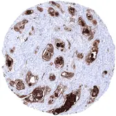 Anti-Kallikrein 7 antibody [MSVA-707M] HistoMAX used in IHC (Paraffin sections) (IHC-P). GTX04475