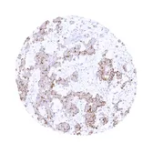 Anti-UPK3B antibody [MSVA-736M] HistoMAX&trade; used in IHC (Paraffin sections) (IHC-P). GTX04476