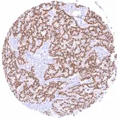 Anti-PAX6 antibody [MSVA-706M] HistoMAX&trade; used in IHC (Paraffin sections) (IHC-P). GTX04487