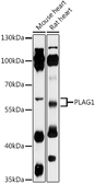 Anti-PLAG1 antibody used in Western Blot (WB). GTX04492