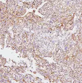 Anti-CYP2E1 antibody used in IHC (Paraffin sections) (IHC-P). GTX04494