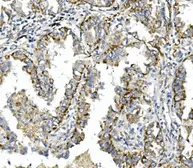 Anti-Integrin beta 4 antibody used in IHC (Paraffin sections) (IHC-P). GTX04496