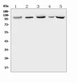 Anti-Polycystin 2 antibody used in Western Blot (WB). GTX04499