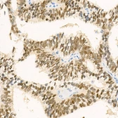 Anti-Nkx3.1 antibody [ARC58355] used in IHC (Paraffin sections) (IHC-P). GTX04500