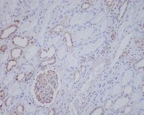 Anti-ALK antibody [20A85] used in IHC (Paraffin sections) (IHC-P). GTX04501