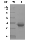 Human K-Ras (G12V mutant) protein, His tag. GTX04508-pro