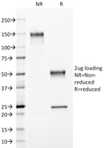 Anti-S100 beta antibody [4C4.9] used in  (). GTX04511