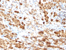 Anti-S100 beta antibody [SPM354] used in IHC (Paraffin sections) (IHC-P). GTX04512