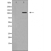 Anti-EphA5 antibody used in Western Blot (WB). GTX04513