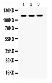 Anti-CARD12 antibody used in Western Blot (WB). GTX04516