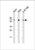 Anti-PLAG1 antibody used in Western Blot (WB). GTX04521