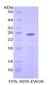 Human Lipocalin-2 protein, His tag. GTX04522-pro