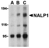 Anti-NALP1 antibody used in Western Blot (WB). GTX04532
