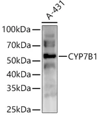 Anti-CYP7B1 antibody used in Western Blot (WB). GTX04545