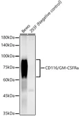 Anti-GM-CSF Receptor alpha antibody [ARC59284] used in Western Blot (WB). GTX04546