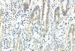 Anti-LGR5 antibody used in IHC (Paraffin sections) (IHC-P). GTX04555