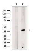 Anti-SP7 antibody used in Western Blot (WB). GTX04567