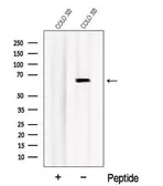 Anti-Nurr1 antibody used in Western Blot (WB). GTX04568
