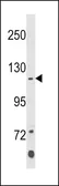 Anti-Klotho antibody used in Western Blot (WB). GTX04569